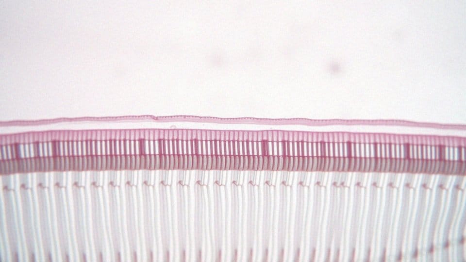 Miofibryle – co to i jakie jest ich znaczenie w mięśniach?